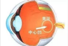 有益老年黄斑部病变的保健食品(第2种功效最多)-LaMaHT辣妈海淘