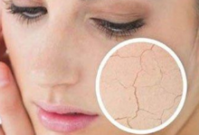 改善皮肤干燥4种维他命-LaMaHT辣妈海淘