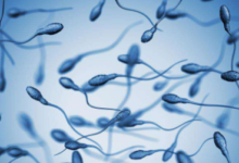 有益湿疹的保健食品-LaMaHT辣妈海淘