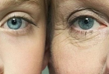 皮肤老化的原因有哪些?为什么皮肤保养吃胶原蛋白?优质胶原蛋白应该怎么选?-LaMaHT辣妈海淘